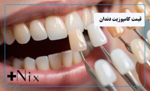 عوامل موثر بر قیمت کامپوزیت