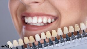 انواع کامپوزیت دندان و کاربردهای آن