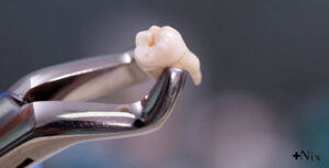 بهداشت دهان بعد از کشیدن دندان