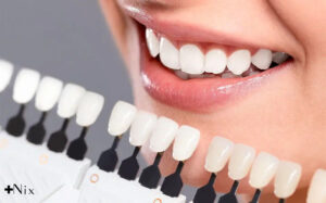 حساسیت بعد از کامپوزیت دندان