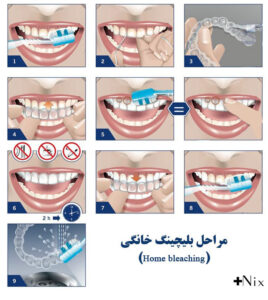 سفید کردن دندان