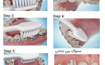 ارتودنسی بزرگسالان