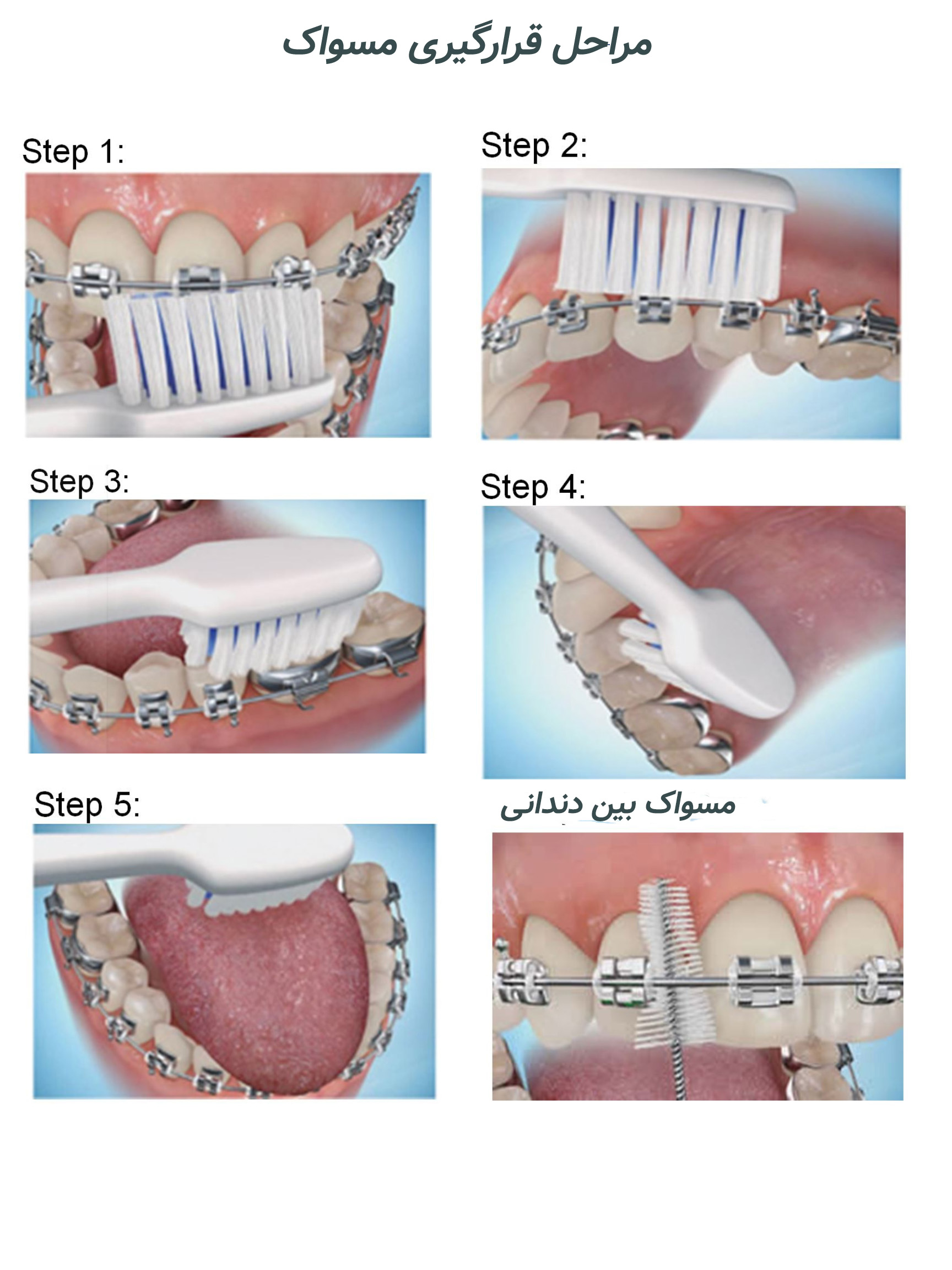 ارتودنسی بزرگسالان