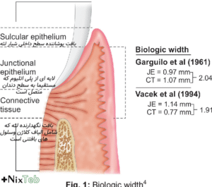 دلایل کشیدن دندان