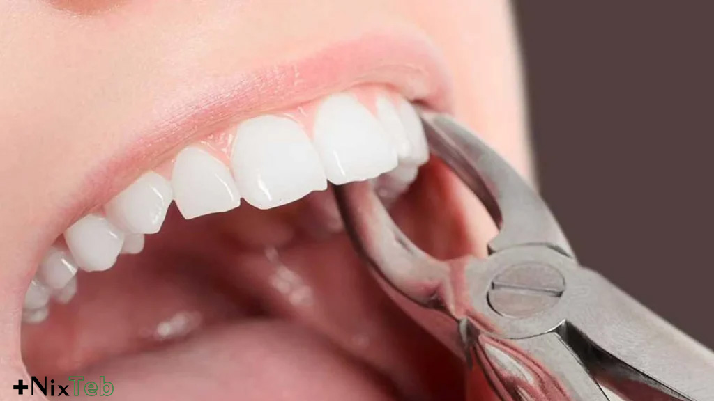 چه زمانی مجبور به کشیدن دندان هستیم