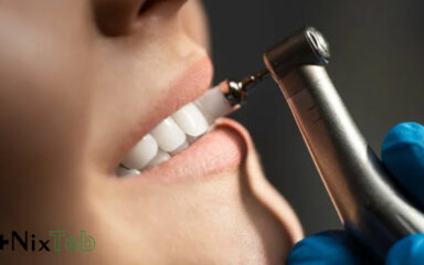 جرم‌گیری دندان