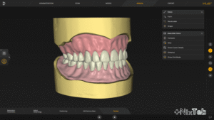 CAD/CAM در دندانپزشکی