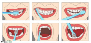 پیشگیری از پوسیدگی دندان