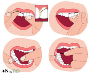 استفاده از نخ دندان