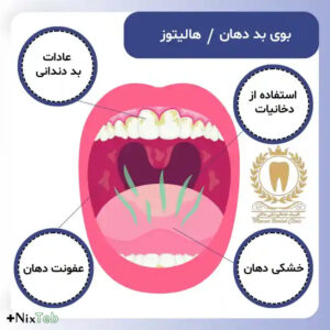 علت هالیتوزیس غیر دهانی