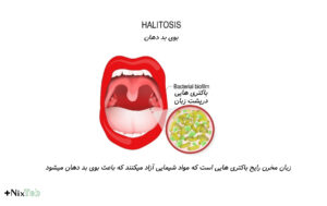 درمان بوی بد دهان با منشأ غیر دندانی