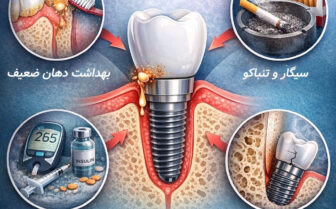عوارض ایمپلنت دندان