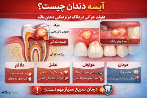 درمان آبسه دندان