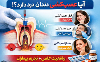 عصب‌کشی دندان درد دارد